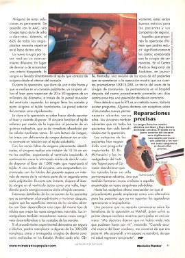 Nuevos láseres permiten a los cirujanos operar corazones palpitantes - Noviembre 1996